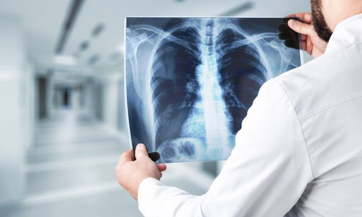 digital x ray